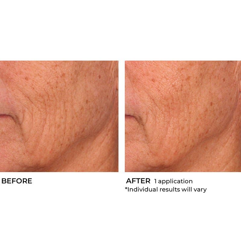 NassifMD Hydro-Screen Intense Hydration Face And Body Souffle