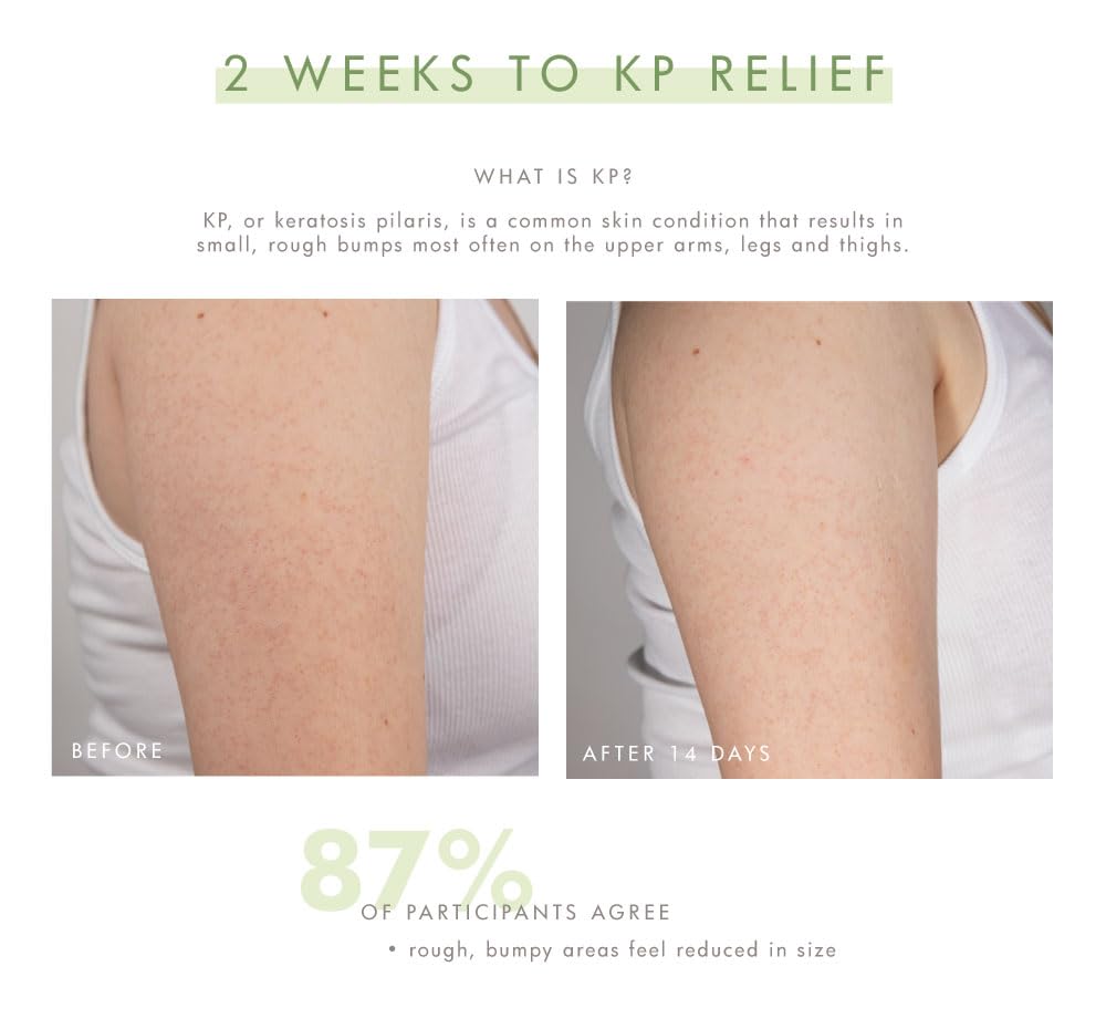 FarmHouse Fresh Smooth Reveal™ Resurfacing Silky Serum