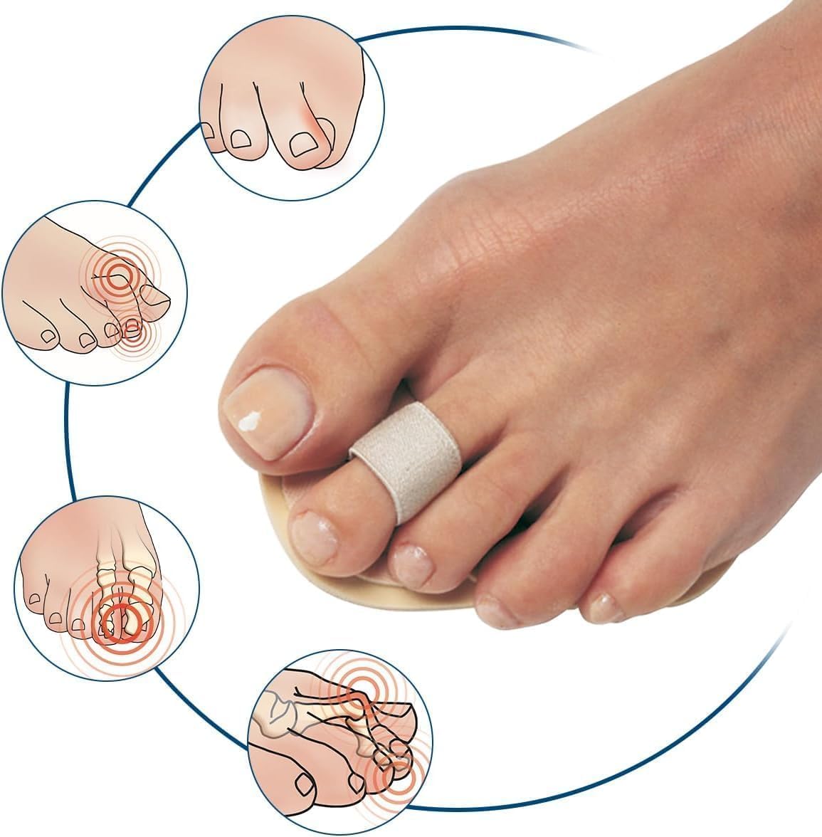 PediFix Podiatrists' Choice Toe Straightener – 3-Pack Toe Aligners Gently Help Realign Crooked, Overlapping, and Hammer Toes – Designed for Comfort and Daily Relief – One Size Fits Most