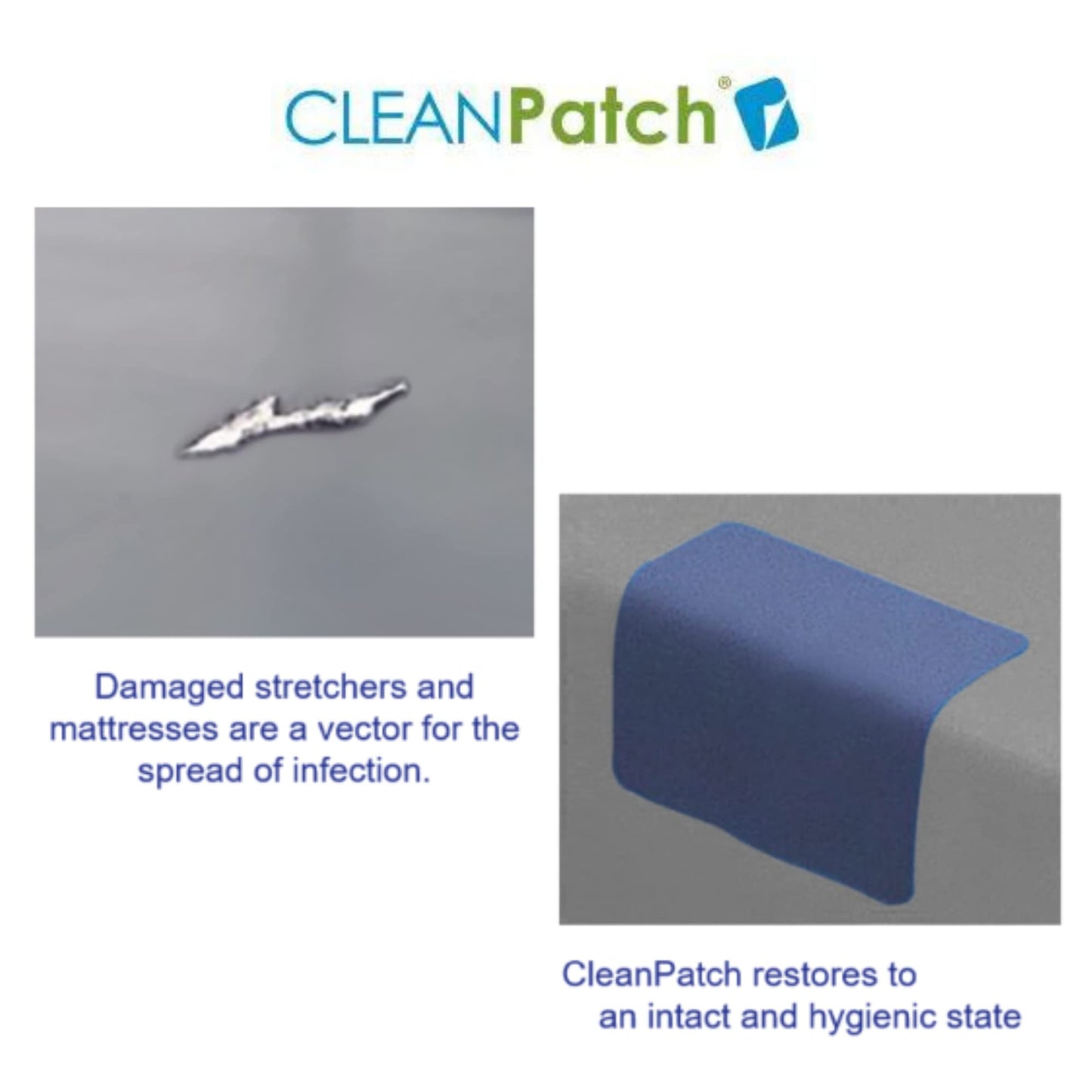Diversey 11003 CLEANPatch Medical Surface Repair Patch for Hospital Beds & Stretchers, 2-Inch Round Patch (10 Patches), 1-Box