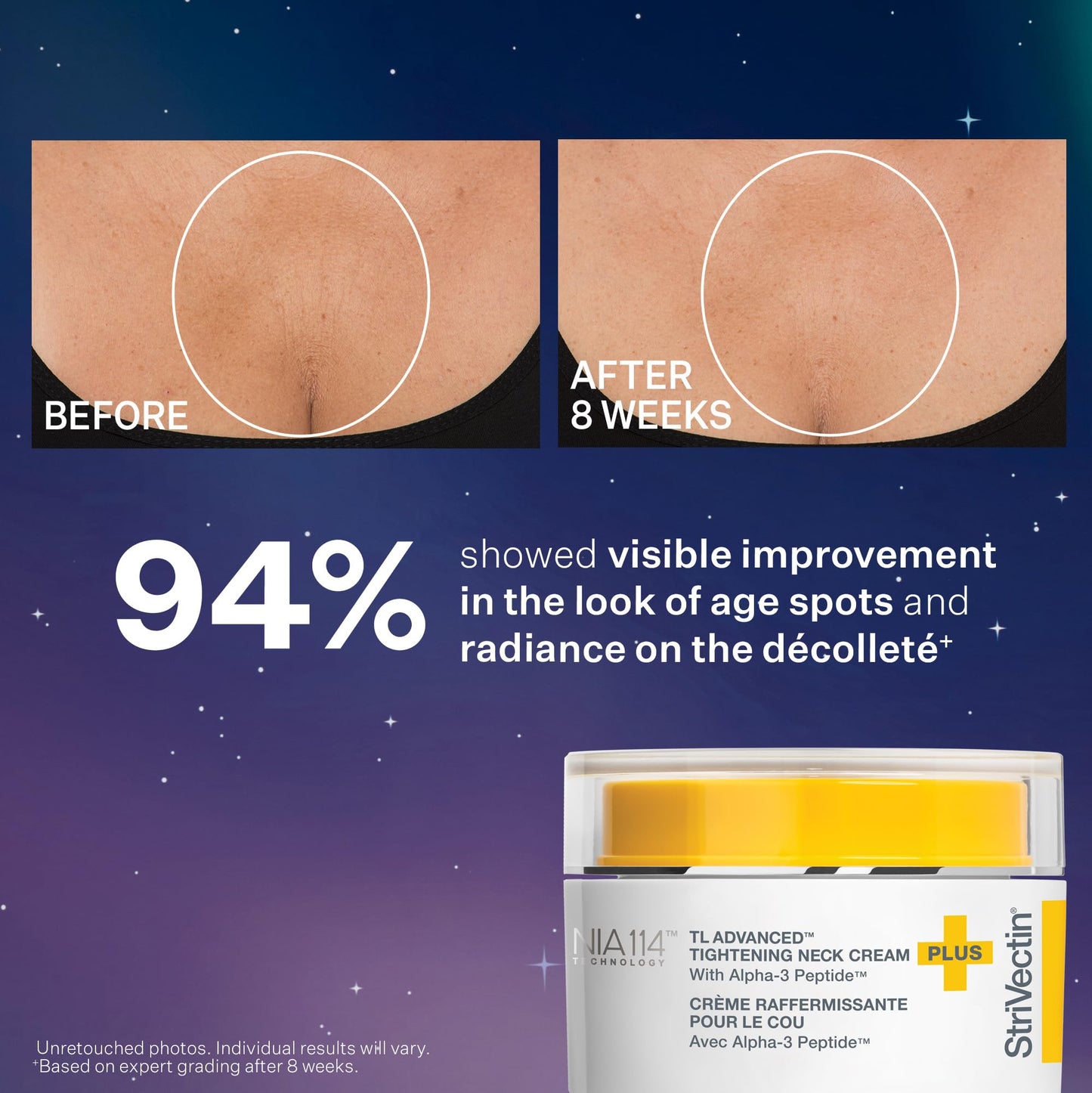 StriVectin TL Advanced Holiday Duo Tighten and Sculpt Kit, Brighten and Lift Skin Tone, Peptides and Hyaluronic Acid