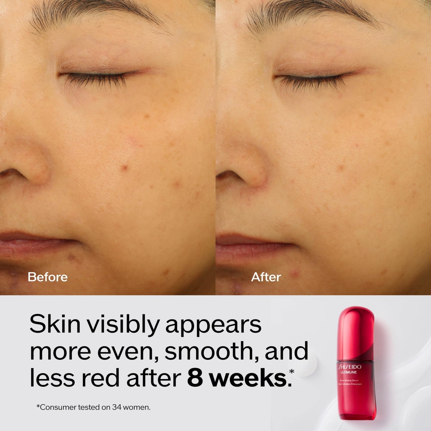 Shiseido Ultimune Power Infusing Serum - Breakthrough Lightweight Face Serum - Boosts Radiance & Improves Visible Signs of Aging - All Skin Types - Non-Comedogenic