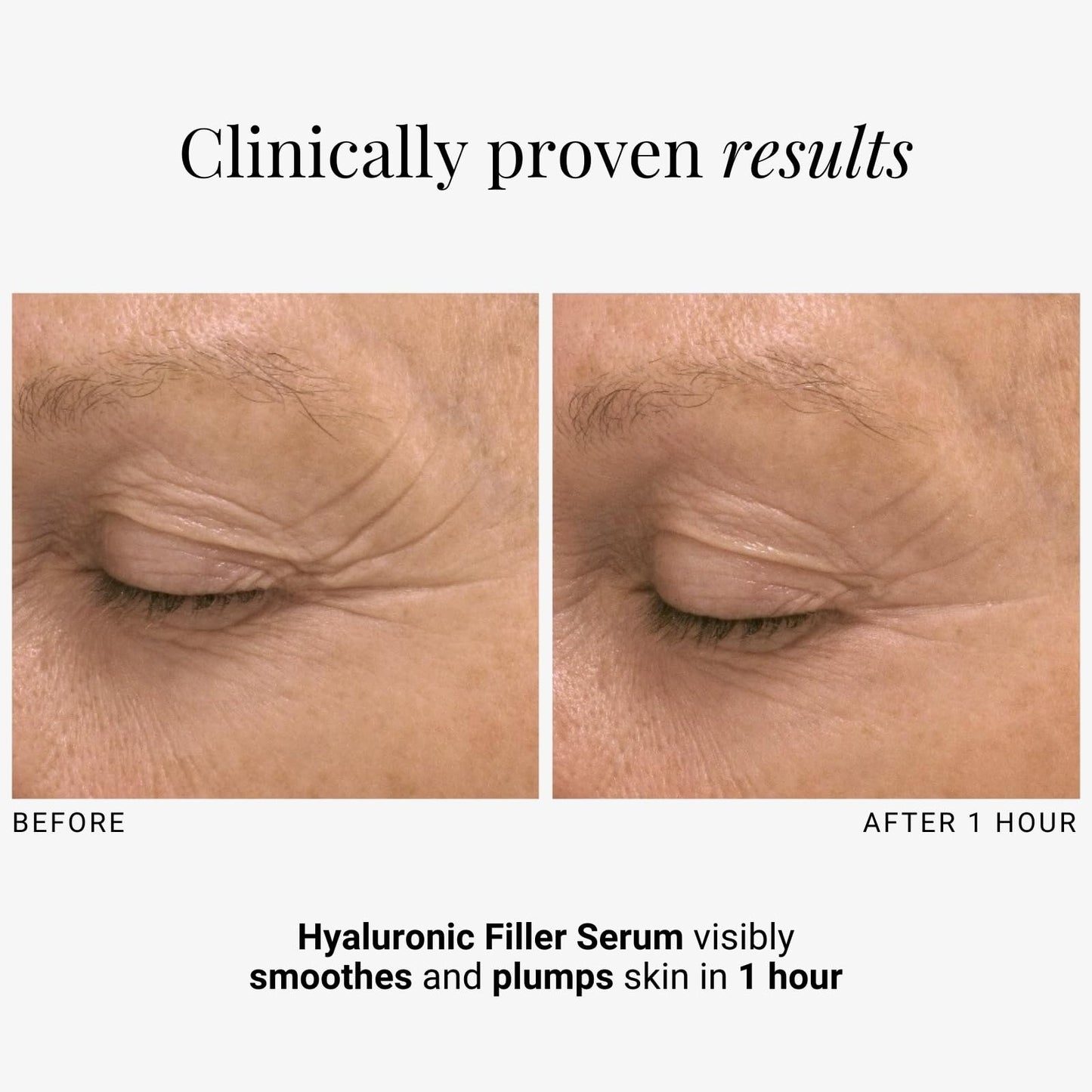 G.M. COLLIN Hyaluronic Filler Serum | Hydrating Hyaluronic Acid for Face | Anti-Aging Formula for Visibly Reducing Wrinkles
