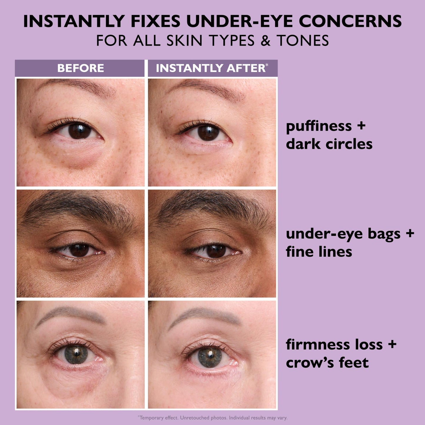 Peter Thomas Roth | Trial-Size Instant FIRMx® Eye Temporary Eye Tightener Easy-Wear Formula | Viral Eye Tightener Cream for Under-Eye Bags & Wrinkles