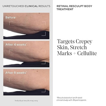 Murad Retinal ReSculpt Body Treatment – Encapsulated Retinal, Shea & Avocado Extract Body Cream to Firm, Lift, and Smooth Crepey Sagging Skin, Targeting Cellulite and Stretch Marks Nightly – 5.0 Fl Oz