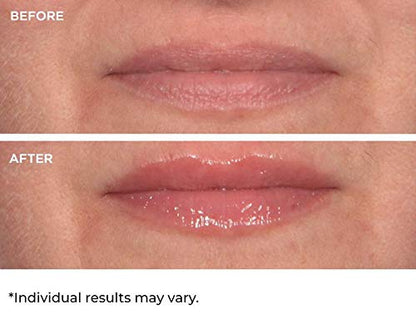 NassifMD Hydro-Screen for Lips