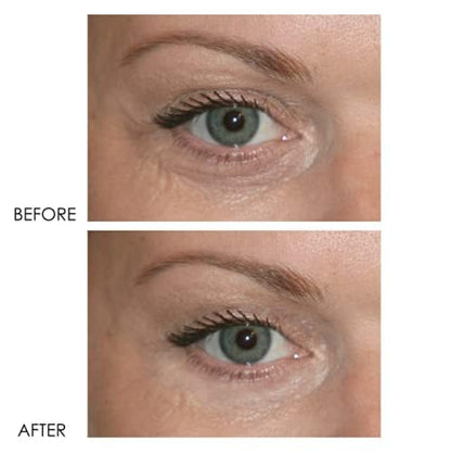 Dermelect Revitalite Eyelid & Dark Circle Corrector- Professional Strength, Anti-Aging Eye Cream with Peptides, Brightening & Tightening Ingredients- Dark Circles, Puffiness, Droopy Eyelids & Wrinkles