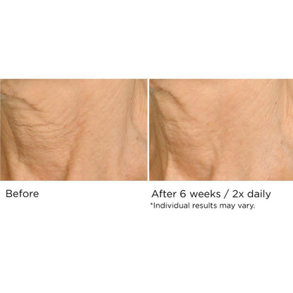 NassifMD Deco-Lift Neck Firming Complex Serum