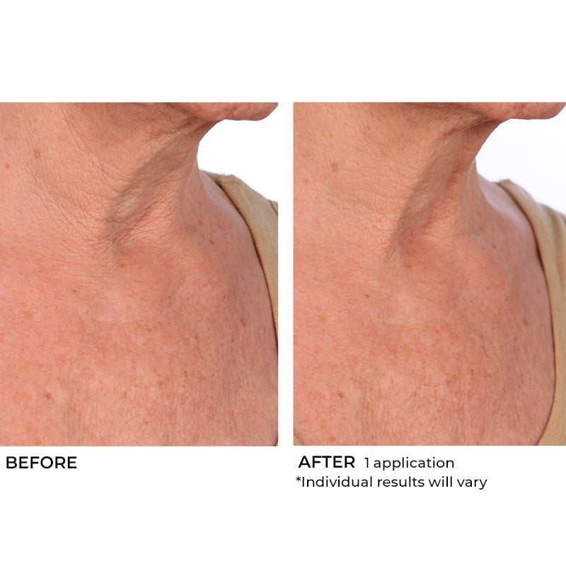 NassifMD Hydro-Screen Intense Hydration Face And Body Souffle