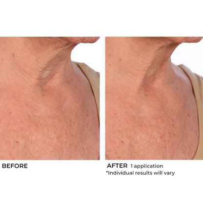 NassifMD Hydro-Screen Intense Hydration Face And Body Souffle