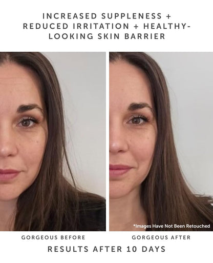 Earth Harbor | HORIZON Ceramide Recovery Serum - Skin Barrier + Hydration | Phytosterols + Blue Lotus + Beta Glucan | 20 ml