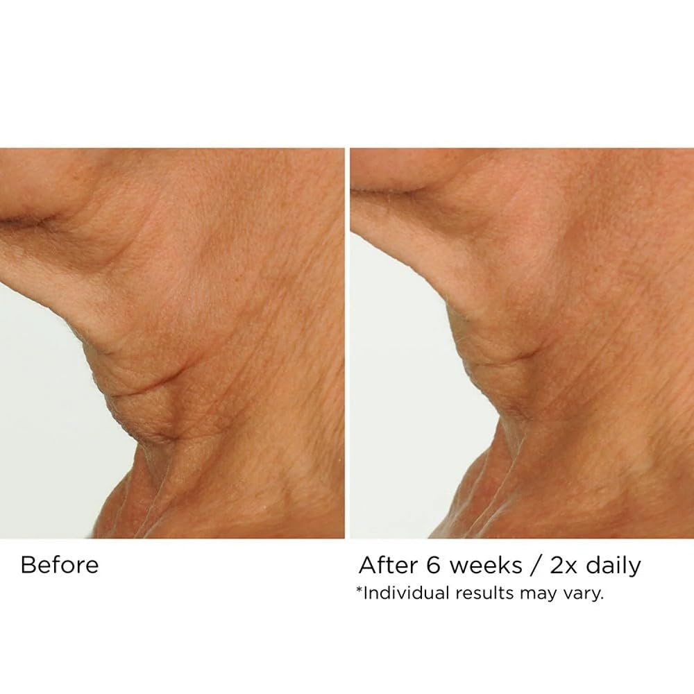 NassifMD Deco-Lift Neck Firming Complex Serum