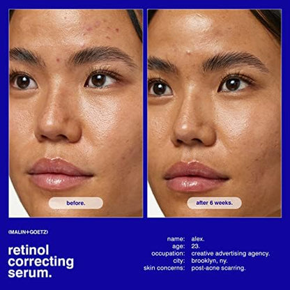 MALIN+GOETZ Retinol Correcting Serum | Multi-Vitamin Retinol Serum with Vitamins A, C, E + Superoxide Dismutase | Smooths Texture, Brightens, Firms + Reduces Fine Lines | Vegan + Cruelty-Free(1 Fl Oz)