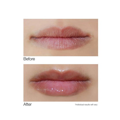 Dermelect Smooth Lip Volumizer for Lips - Anti Aging Plumper with Argan Oil, Shea Butter, Coconut Oil, Hyaluronic Acid Vitamin C Silkflo Hydrating Conditioning Lip Primer for Dryness Thin Lips .24 oz