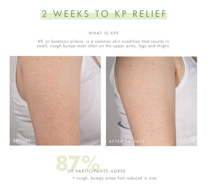 FarmHouse Fresh Smooth Reveal™ Resurfacing Silky Serum