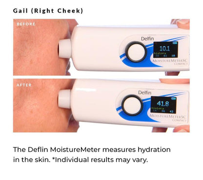 NassifMD 3HA Instant Hydrating Facial Mist - Contains 3 Types of Hyaluronic Acid to Keep Your Face Refreshed and Hydrated, Decreases Look of Skin Puffiness, Dark Circles and Fine Lines