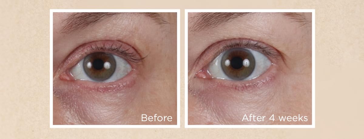 Vitamin C Ester CCC+ Ferulic Brightening Under-Eye Cream, 0.5 fl. oz.