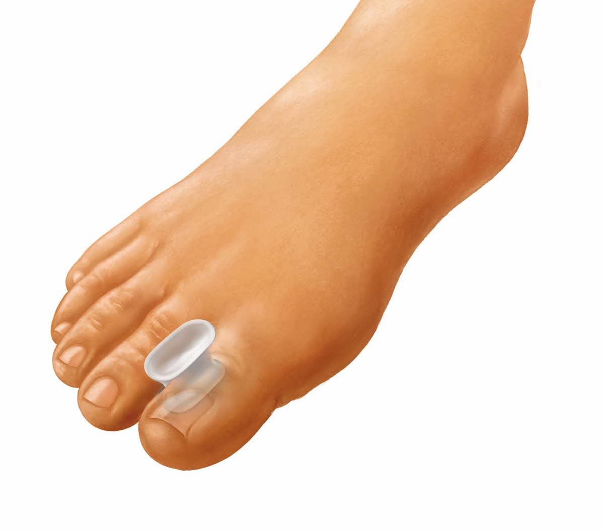 Medline Gel Toe Spacers, Helps Align and Straighten Toes, Relieves Bunion and Toe Discomfort, Reusable, Small, Pack of 4