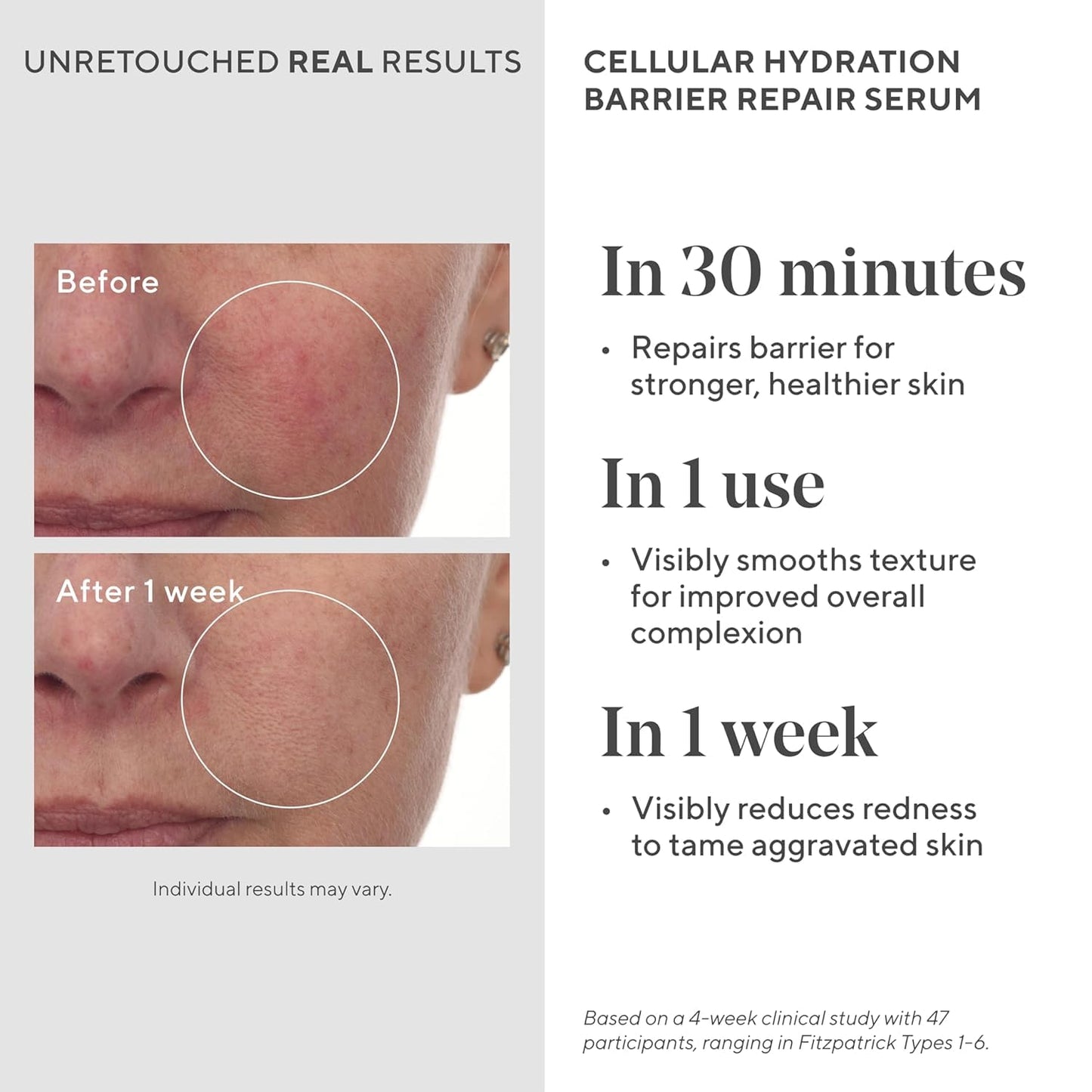 Murad Cellular Hydration Barrier Repair Serum - Hydrating Face Serum Repairs Lipid-Depleted Skin Barrier- Hexapeptide-9, Bilberry, and Hyaluronic Acid Delivers Stronger Healthier Skin