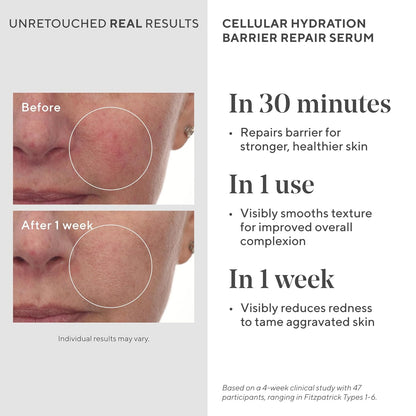 Murad Cellular Hydration Barrier Repair Serum - Hydrating Face Serum Repairs Lipid-Depleted Skin Barrier- Hexapeptide-9, Bilberry, and Hyaluronic Acid Delivers Stronger Healthier Skin