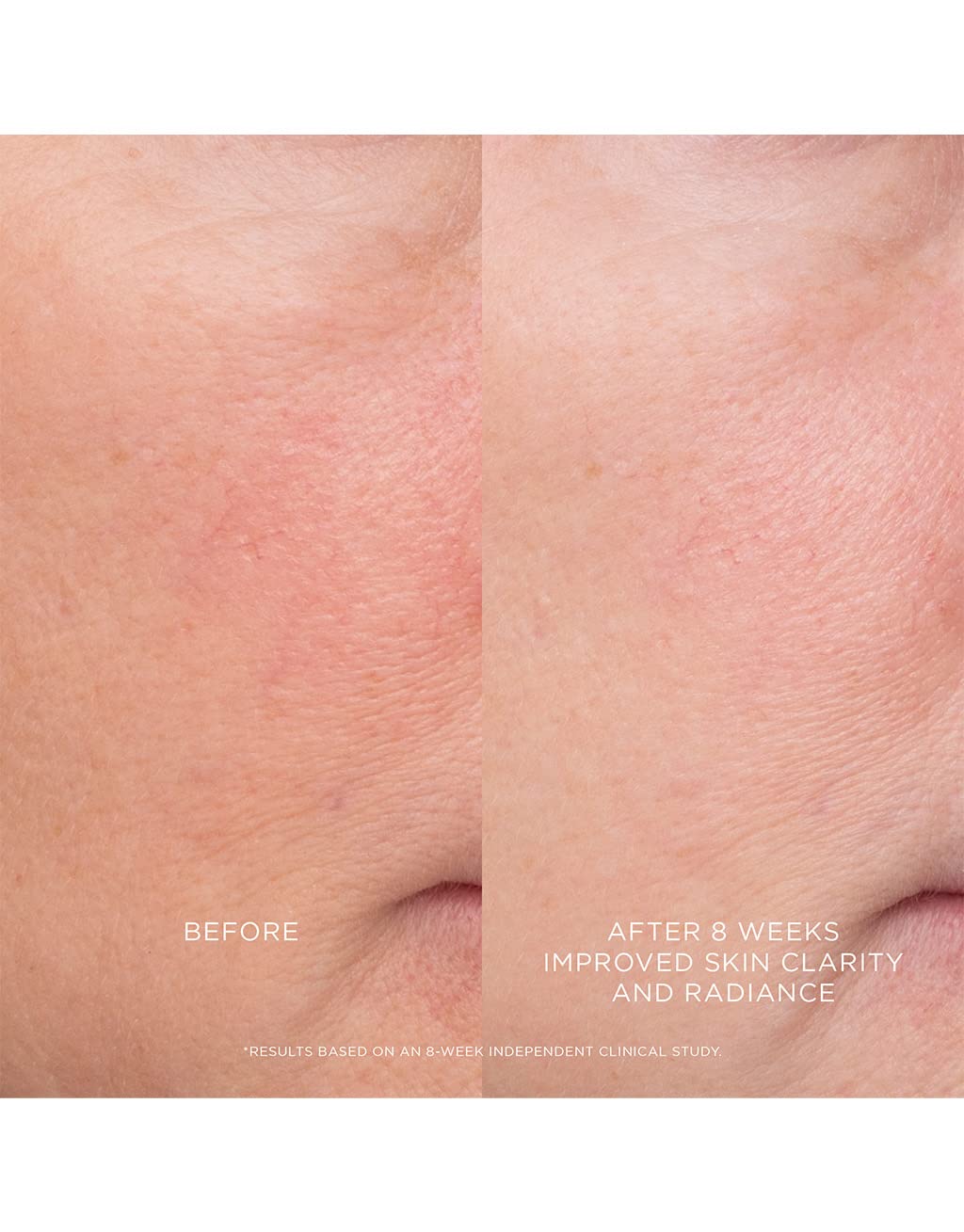Hourglass Equilibrium Resurfacing Retinoid Treatment
