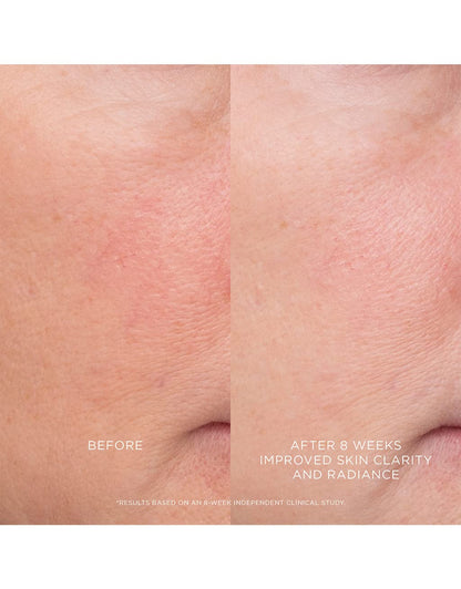 Hourglass Equilibrium Resurfacing Retinoid Treatment