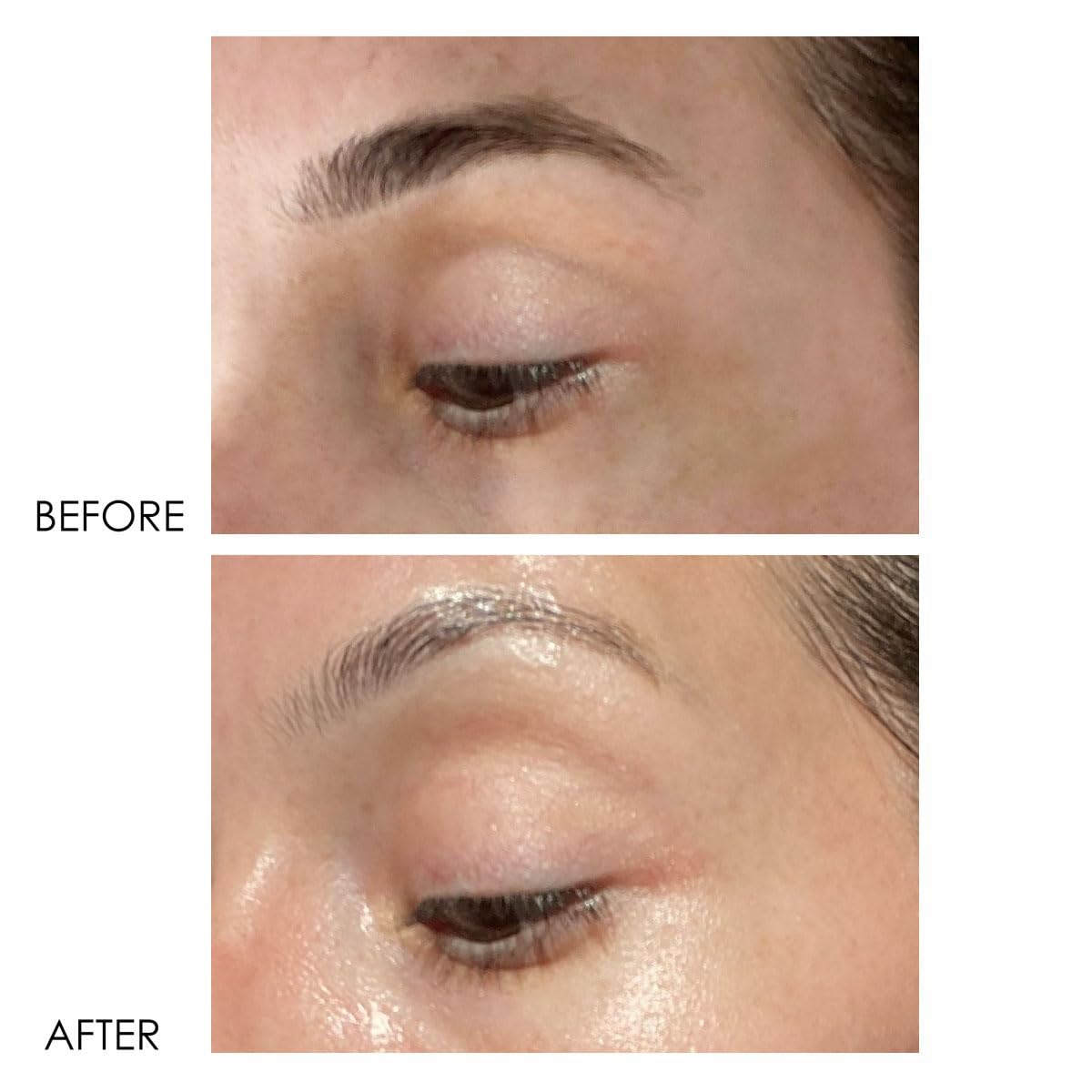 Dermelect Revitalite Eyelid & Dark Circle Corrector- Professional Strength, Anti-Aging Eye Cream with Peptides, Brightening & Tightening Ingredients- Dark Circles, Puffiness, Droopy Eyelids & Wrinkles