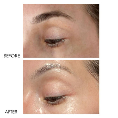 Dermelect Revitalite Eyelid & Dark Circle Corrector- Professional Strength, Anti-Aging Eye Cream with Peptides, Brightening & Tightening Ingredients- Dark Circles, Puffiness, Droopy Eyelids & Wrinkles