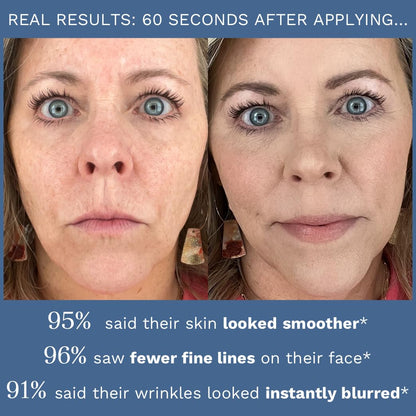City Beauty Line-Blurring Wrinkle Filler – Spot Solution for Wrinkles & Fine Lines – Smooth, Firm & Hydrated Skin for Face & Neck – Clean Formula with Peptides & Diamond Powder