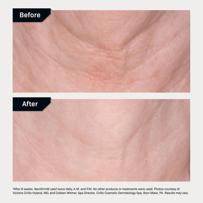 Revision Skincare Nectifirm® Neck Cream – Clinically Proven to Firm, Lift & Smooth the Neck and Jawline, Brightening Skin and Reducing Early Signs of Aging
