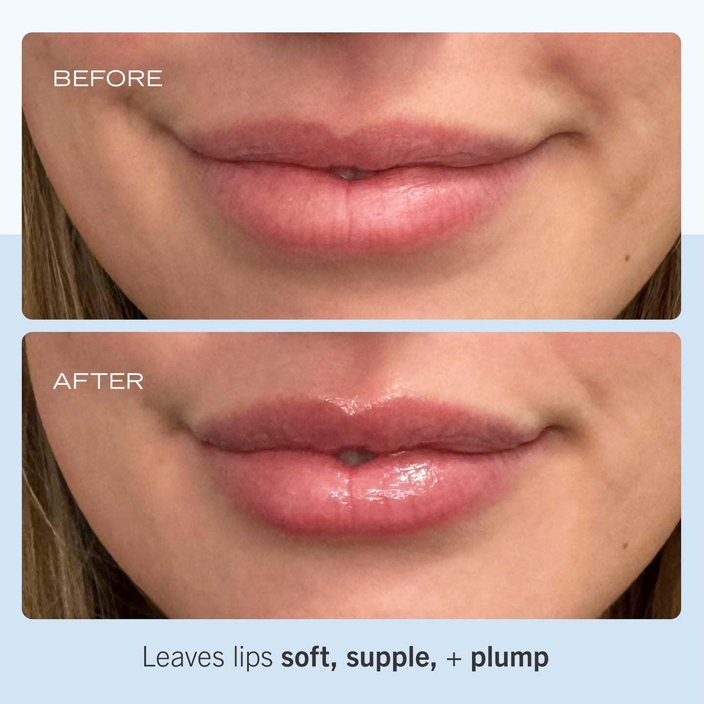 First Aid Beauty - Ultra Repair Lip Balm, Instant Hydration and Moisture for Soft, Supple & Plump Lips, Concentrated Formula of Botanical Oils, Butters & Waxes, Cruelty Free, 0.25 oz