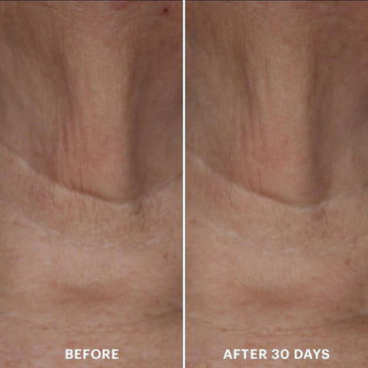 Glo Skin Beauty Bio-Renew EGF Neck Cream - Epidermal Growth Factor Neck + Décolleté Cell Repairing Formula, Reduce the Appearance of Wrinkles, Fine Lines Crepey & Sagging Skin