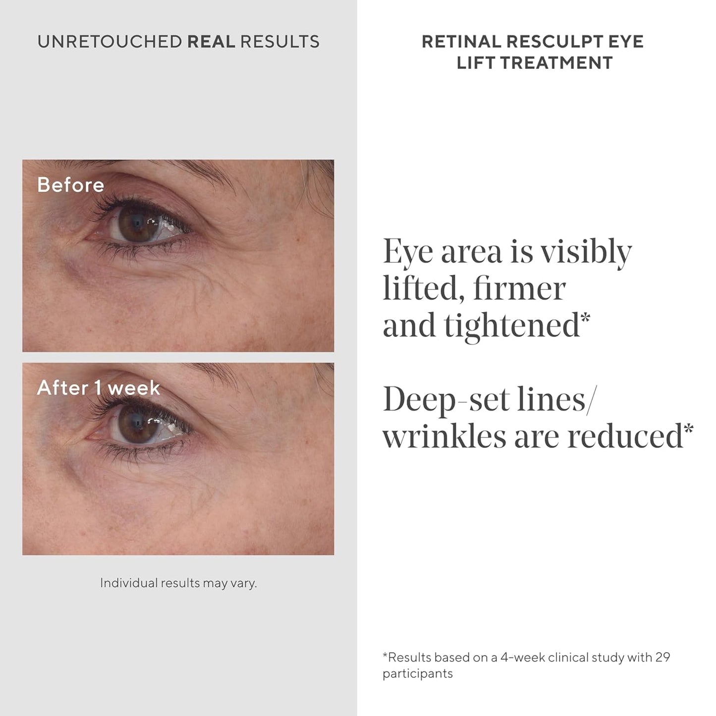 Murad Retinal ReSculptors – 2-Piece Full Size Kit ($197 Value) - Retinal Serum & Eye Cream - 2.5x Vitamin A, Lifts, Firms, Anti-Aging, Encapsulated Retinal, Reduces Wrinkles on Face, Eyes & Neck