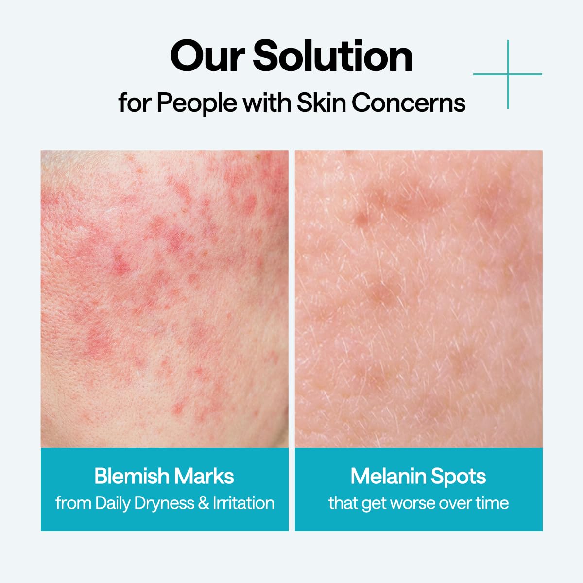 Mediheal Wrapping Serum Mask Blemish Repair – Intensive Calming & Repair Care with 98% Pure Madecassoside & CICA Complex – Helps Calm Skin's Blemish Spots (10 Sheets)