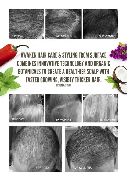 Surface Hair - Awaken Therapeutic Treatment - Natural Ingredients for Thinning Hair and a Healthy Scalp