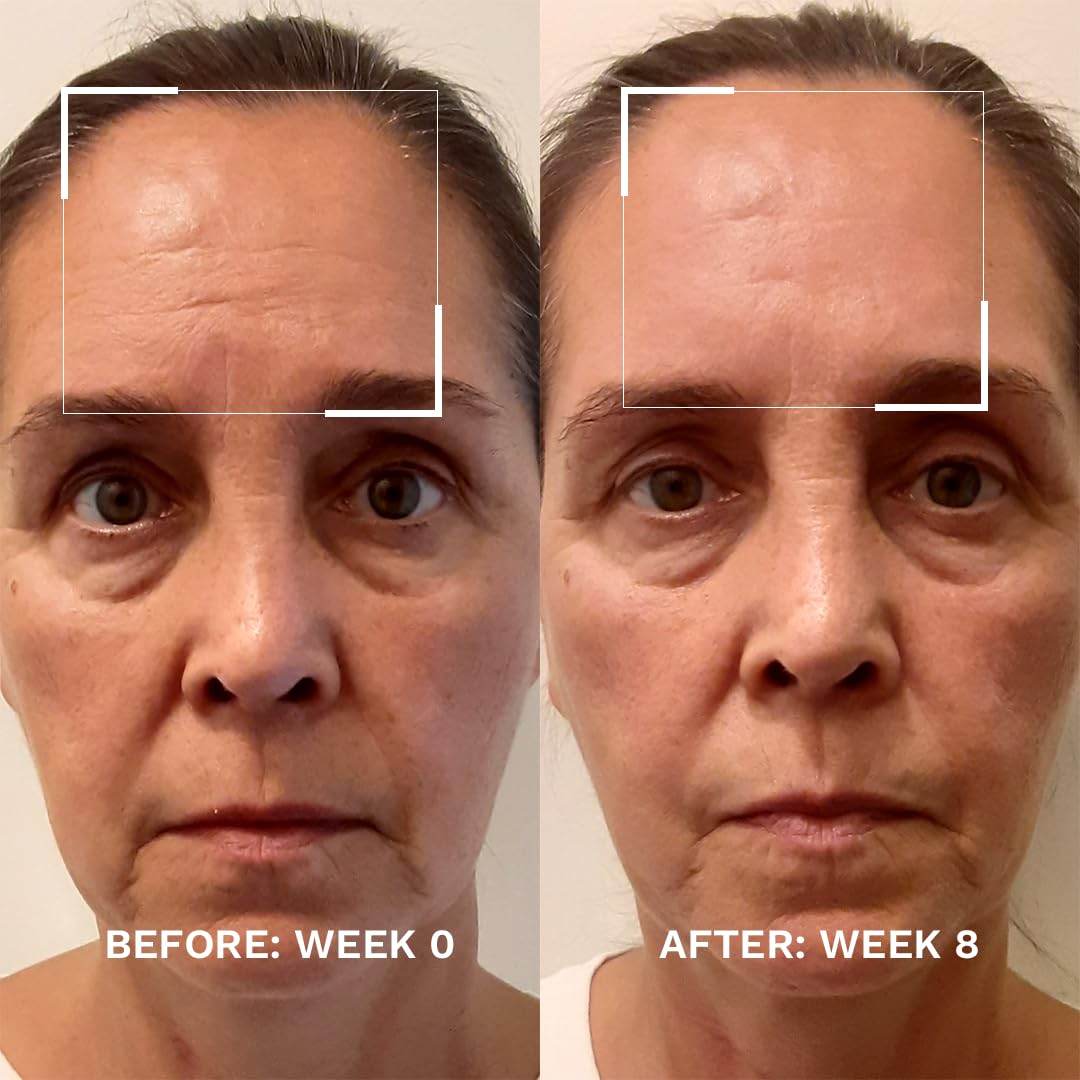 City Beauty Skin-Lifting Booster - Anti-Aging Booster Serum for Face - Lift & Tighten - Sagging Skin Solution with Peptides - Visibly Smooth Fine Lines & Wrinkles - Cruelty-Free, Clean Skin Care