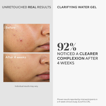 Murad Clarifying Water Gel – Lightweight Face Moisturizer for Acne-Prone Skin with Salicylic and Hyaluronic Acid for Breakout Prevention, Hydration, and Shine-Free Finish – 2 Fl Oz