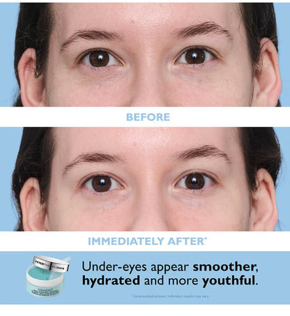 Peter Thomas Roth | Patch + Go Eye Patch Travel Pack