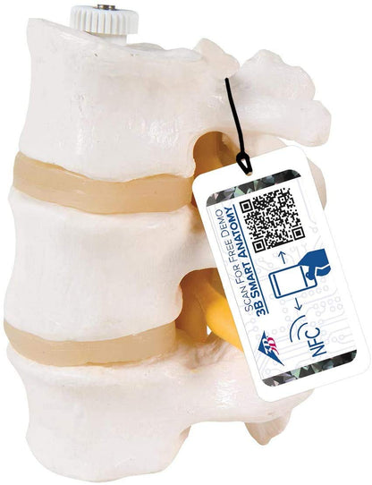 3B Scientific A76/8 3 Lumbar Vertebrae Flexibly Mounted + Free Anatomy App - 3B Smart Anatomy