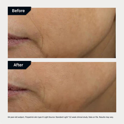 Revision Skincare D·E·J Face Cream®, Advanced Anti Aging Moisturizer, Lifting and Firming, Antioxidant Rich