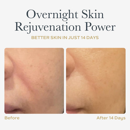 SOTHYS Renovative Micro-Capsules - Vitamin C Serum for Face | Vegan Capsules | Anti-Aging, Dark Spot | Night Treatment | 60 x .01 Fl Oz