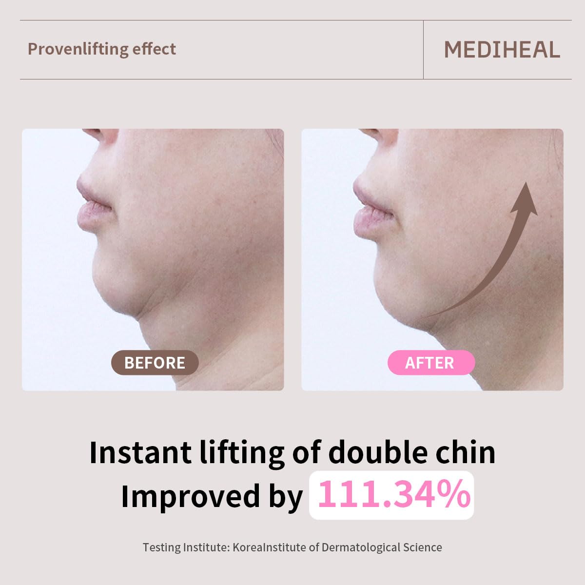 Mediheal Retinol Collagen Ampoule Lifting Mask (10 Counts) forV Line Mask, Anti-Aging - Helps Reduce Fine Lines & Wrinkles, and Smoothens Skin