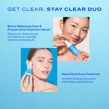 Murad Biome-Balancing Acne Treatment – Salicylic, Mandelic, and Glutamic Acid Serum for Clearing and Preventing Breakouts, Decongesting Pores, and Balancing Skin Microbiome – 1.0 Fl Oz