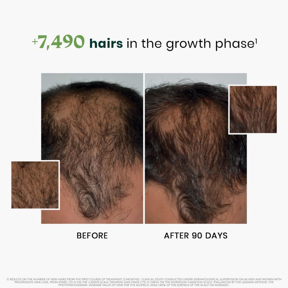 Rene Furterer Triphasic Progressive Concentrated Serum for Hereditary, Hormonal Thinning Hair - Drug-Free - Receding Hairline - Leave-In - Sulfate, Paraben, Silicone-Free - 8 ct., 30-Day Supply