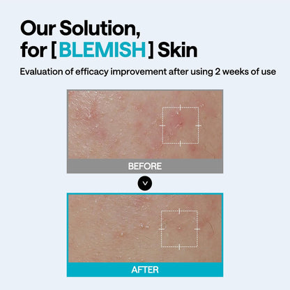 Mediheal Wrapping Serum Mask Blemish Repair – Intensive Calming & Repair Care with 98% Pure Madecassoside & CICA Complex – Helps Calm Skin's Blemish Spots (10 Sheets)