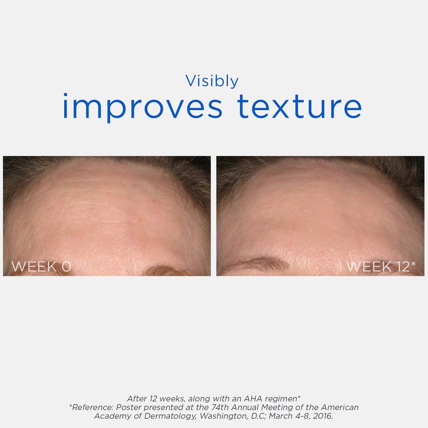 NEOSTRATA Smooth Surface Glycolic At-Home Chemical Peel High-strength Exfoliating Treatment Fragrance-Free, Oil-Free, 2 fl. oz.