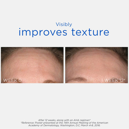 NEOSTRATA Smooth Surface Glycolic At-Home Chemical Peel High-strength Exfoliating Treatment Fragrance-Free, Oil-Free, 2 fl. oz.