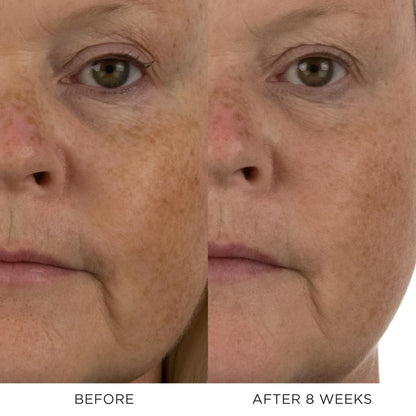 Absolute Active Replenishing Moisturizer DOSE