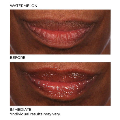 NassifMD Hydro-Screen for Lips