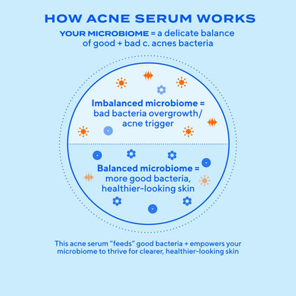 Murad Biome-Balancing Acne Treatment – Salicylic, Mandelic, and Glutamic Acid Serum for Clearing and Preventing Breakouts, Decongesting Pores, and Balancing Skin Microbiome – 1.0 Fl Oz